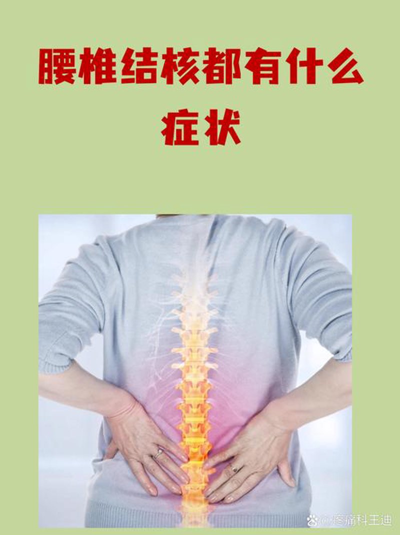 揭开脊椎病的伪装：警惕常见误区