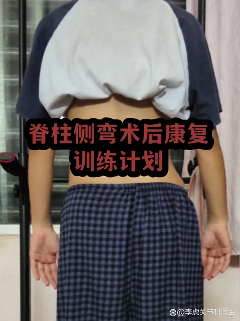 脊椎健康评估